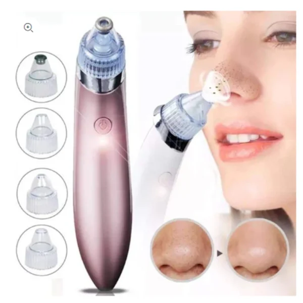 Facial Blackheads Removal XN-8030